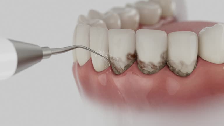 Trusted Teeth Cleaning And Checkup service in Rural Hill, TN - Dentist Open Now